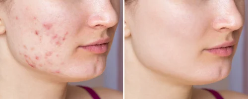 skin-changes