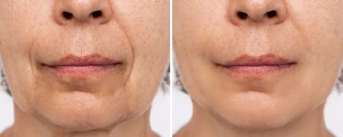 skin-changes