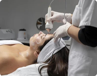 acne treatment