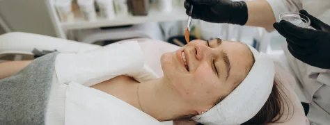acne treatment