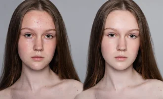 skin results