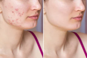 skin results