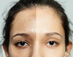 skin results